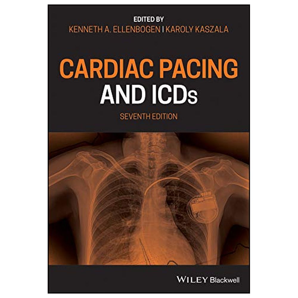 Cardiac Pacing And ICDs