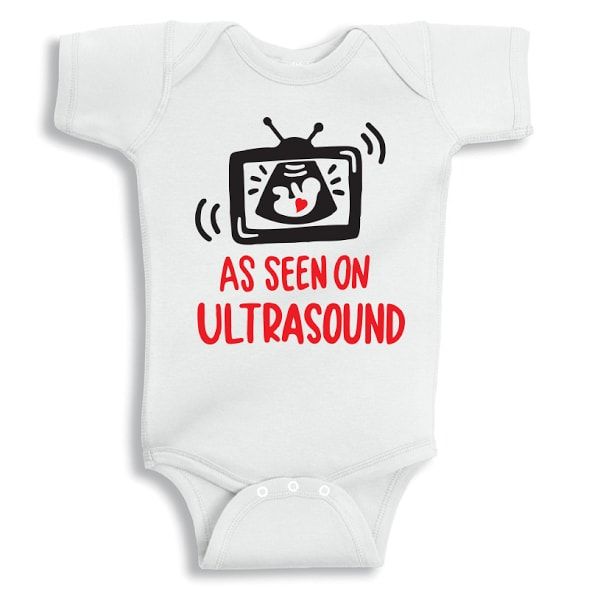 Twinkle Hands - As Seen On Ultrasound Onesie